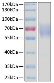 Recombinant Human LMIR1/CD300a Protein was determined by SDS-PAGE under reducing conditions with Coomassie Blue.