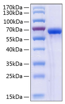 Recombinant Human NKG2D ligand 2/ULBP2 Protein was determined by SDS-PAGE under reducing conditions with Coomassie Blue.