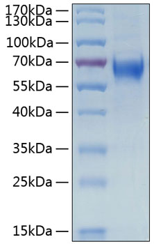 Recombinant Human IL-6RA/CD126 Protein was determined by SDS-PAGE under reducing conditions with Coomassie Blue.