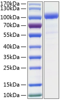 Recombinant Human CSF3R/G-CSF-R/CD114 Protein was determined by SDS-PAGE under reducing conditions with Coomassie Blue.