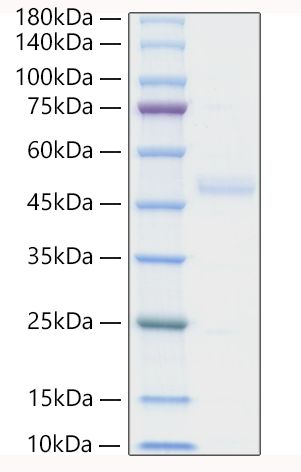 Recombinant Human IL1RL1/ST2 Protein was determined by SDS-PAGE under reducing conditions with Coomassie Blue.