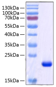 Recombinant Human Retinol-binding protein 4/PRBP Protein was determined by SDS-PAGE under reducing conditions with Coomassie Blue.