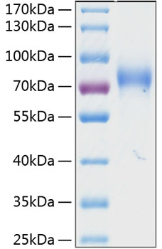 Recombinant Human NKAT-2/KIR2DL3/CD158b2 Protein was determined by SDS-PAGE under reducing conditions with Coomassie Blue.