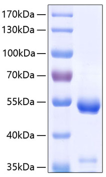 Recombinant Human Carboxypeptidase E/CPE Protein was determined by SDS-PAGE under reducing conditions with Coomassie Blue.