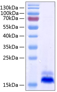 Recombinant Human TNFRSF10B/DR5/TRAIL-R2/CD262 Protein was determined by SDS-PAGE under reducing conditions with Coomassie Blue.