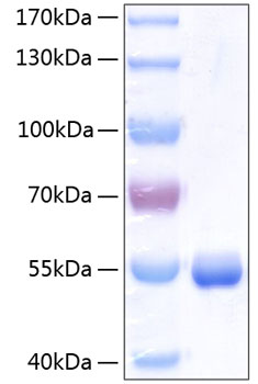 Recombinant Human Retinol-binding protein 4/PRBP Protein was determined by SDS-PAGE under reducing conditions with Coomassie Blue.