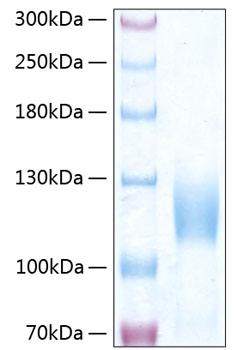 Recombinant Human Trk-C/NTRK3 Protein was determined by SDS-PAGE under reducing conditions with Coomassie Blue.