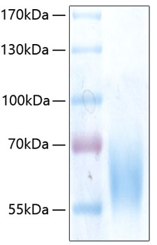 Recombinant Human Trk-B/NTRK2 Protein was determined by SDS-PAGE under reducing conditions with Coomassie Blue.