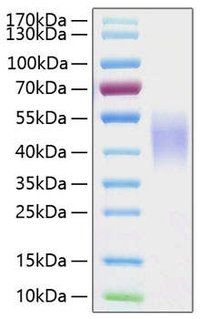 Recombinant Human Fc-gamma RIII beta/FCGR3B/CD16b Protein was determined by SDS-PAGE under reducing conditions with Coomassie Blue.