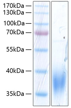 Recombinant Human SLAMF7/CRACC/CD319 Protein was determined by SDS-PAGE under reducing conditions with Coomassie Blue.
