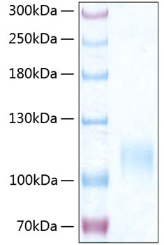 Recombinant Human E-selectin/SELE/CD62E Protein was determined by SDS-PAGE under reducing conditions with Coomassie Blue.