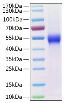Recombinant Human uPAR/PLAUR/CD87 Protein was determined by SDS-PAGE under reducing conditions with Coomassie Blue.