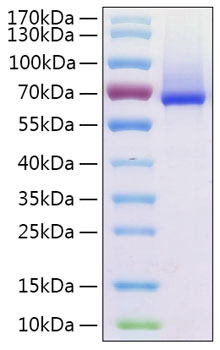 Recombinant Human Glypican-1/GPC1 Protein was determined by SDS-PAGE under reducing conditions with Coomassie Blue.