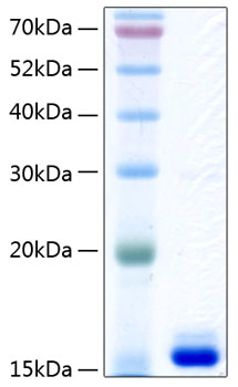 Recombinant Human Transthyretin/TTR Protein was determined by SDS-PAGE under reducing conditions with Coomassie Blue.