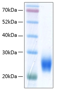 Recombinant Human NKG2D ligand 2/ULBP2 Protein was determined by SDS-PAGE under reducing conditions with Coomassie Blue.
