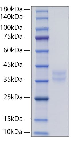 Recombinant Human IL-2RB/CD122 Protein was determined by SDS-PAGE under reducing conditions with Coomassie Blue.