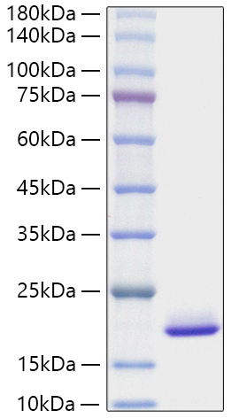 Recombinant Mouse FGF-1/aFGF Protein was determined by SDS-PAGE under reducing conditions with Coomassie Blue.