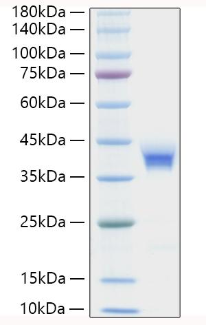 Recombinant Human BST-1/CD157 Protein was determined by SDS-PAGE under reducing conditions with Coomassie Blue.