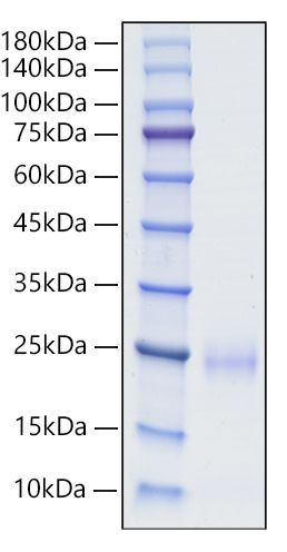 Recombinant Human BY55/CD160 Protein was determined by SDS-PAGE under reducing conditions with Coomassie Blue.