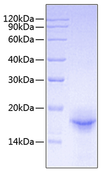 Recombinant Mouse IL-33 Protein was determined by SDS-PAGE under reducing conditions with Coomassie Blue.