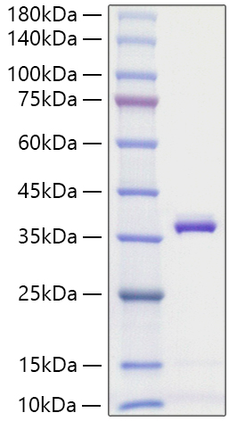 Recombinant Mouse Apolipoprotein E/APOE Protein was determined by SDS-PAGE under reducing conditions with Coomassie Blue.