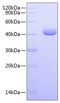 Recombinant Human Nectin-4/PVRL4 Protein was determined by SDS-PAGE under reducing conditions with Coomassie Blue.