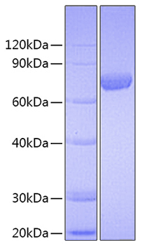 Recombinant Human C7orf50(Cholesin) Protein was determined by SDS-PAGE under reducing conditions with Coomassie Blue.