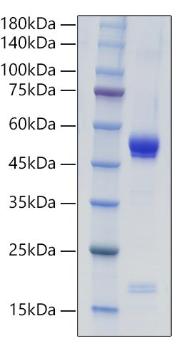 Recombinant Mouse IL-21 Protein was determined by SDS-PAGE under reducing conditions with Coomassie Blue.