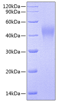 Recombinant Human Alkaline phosphatase (Intestinal type)/ALPI Protein was determined by SDS-PAGE under reducing conditions with Coomassie Blue.