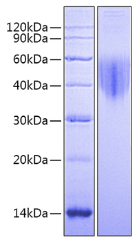 Recombinant Mouse Alkaline Phosphatase (Germ type) /ALPG Protein was determined by SDS-PAGE under reducing conditions with Coomassie Blue.
