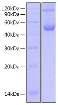 Recombinant Mouse IFN-alpha 4 Protein was determined by SDS-PAGE under reducing conditions with Coomassie Blue.