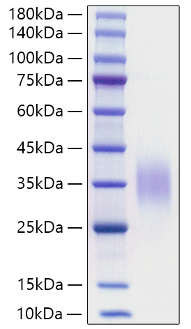 Recombinant Mouse CD47 Protein was determined by SDS-PAGE under reducing conditions with Coomassie Blue.