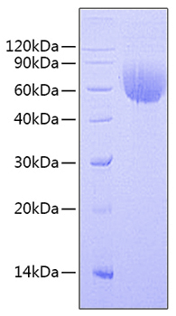 Recombinant Human BLNK Protein was determined by SDS-PAGE under reducing conditions with Coomassie Blue.