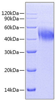 Recombinant Mouse IFN-alpha 6 Protein was determined by SDS-PAGE under reducing conditions with Coomassie Blue.