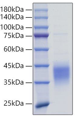 Recombinant Mouse TNFSF9/4-1BB Ligand Protein was determined by SDS-PAGE under reducing conditions with Coomassie Blue.