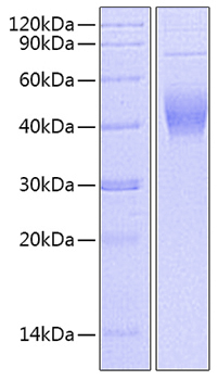 Recombinant Mouse IL-2 (C160S) Protein was determined by SDS-PAGE under reducing conditions with Coomassie Blue.