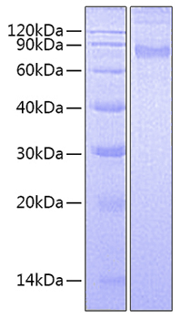 Recombinant Human CCL11/Eotaxin Protein was determined by SDS-PAGE under reducing conditions with Coomassie Blue.