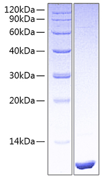 Recombinant Human LR3-IGF-1(E51R) Protein was determined by SDS-PAGE under reducing conditions with Coomassie Blue.