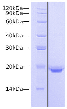 Recombinant Human IL-17F Protein was determined by SDS-PAGE under reducing conditions with Coomassie Blue.