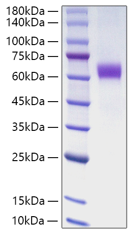 Recombinant Human Jagged1/JAG1/CD339 Protein was determined by SDS-PAGE under reducing conditions with Coomassie Blue.
