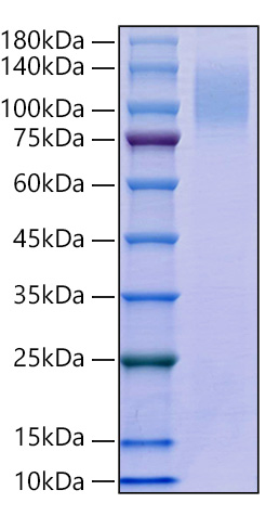 Recombinant Human TACTILE/CD96 Protein was determined by SDS-PAGE under reducing conditions with Coomassie Blue.