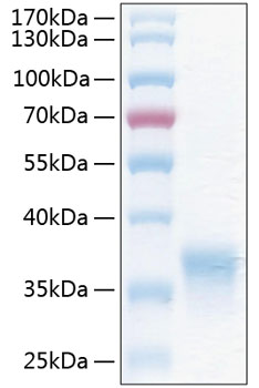 Recombinant Human HCVADR/CXADR Protein was determined by SDS-PAGE under reducing conditions with Coomassie Blue.