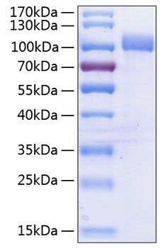 Recombinant Human VCAM-1/CD106 Protein was determined by SDS-PAGE under reducing conditions with Coomassie Blue.