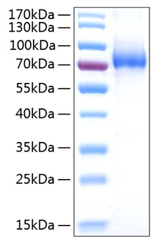 Recombinant Human IL-7RA/CD127 Protein was determined by SDS-PAGE under reducing conditions with Coomassie Blue.