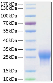 Recombinant Human ALK-1/ACVRL1 Protein was determined by SDS-PAGE under reducing conditions with Coomassie Blue.