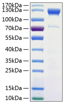 Recombinant Human Semaphorin-4D/SEMA4D/CD100 Protein was determined by SDS-PAGE under reducing conditions with Coomassie Blue.
