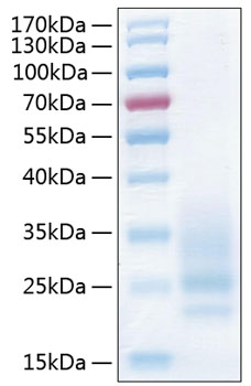 Recombinant Human CD83 Protein was determined by SDS-PAGE under reducing conditions with Coomassie Blue.