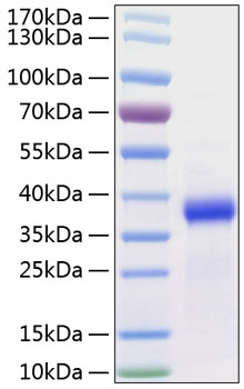 Recombinant Human Follistatin-like protein 3/FSTL3 Protein was determined by SDS-PAGE under reducing conditions with Coomassie Blue.