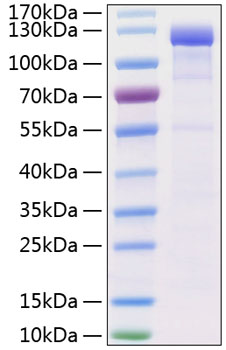 Recombinant Human VE-cadherin/CDH5/CD144 Protein was determined by SDS-PAGE under reducing conditions with Coomassie Blue.