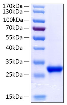Recombinant Human Tetranectin/CLEC3B Protein was determined by SDS-PAGE under reducing conditions with Coomassie Blue.